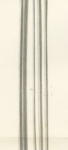 Spinal Cord and Its Serial Sections, Hirschfeld Double Folding Plate, 1866, view 6