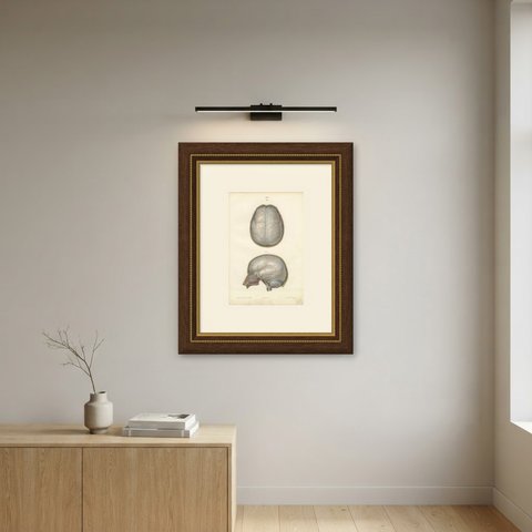 The Dura Mater of the Brain, Antique Hirschfeld Anatomy Print, 1866, shown framed on a wall