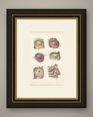 Vessels of the Eyelids and Orbit, Antique Hirschfeld Anatomy Print, 1866, shown framed