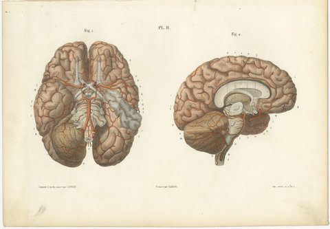 Arteries of the Brain, Antique Hirschfeld Anatomy Print, 1866, view 2