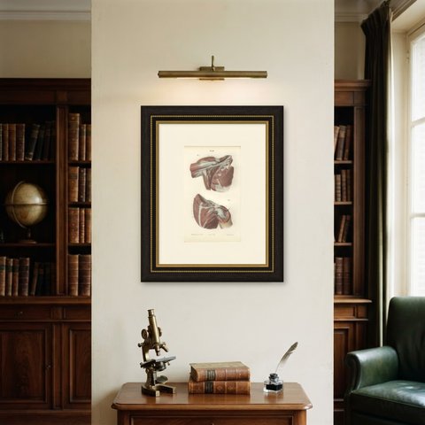 The Axilla and the Cords of the Plexus, Antique Hirschfeld Anatomy Print, 1866, shown framed on a wall