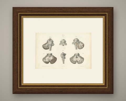 The Brain Stem and Cerebellum, Antique Hirschfeld Anatomy Print, 1866, shown framed