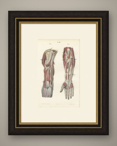 The Humerus and the Nerve Trunks of the Arm, Hirschfeld Anatomy Print, 1866, shown framed