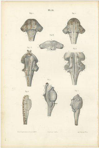 The Brain Stem and Fourth Ventricle, Antique Hirschfeld Anatomy Print, 1866, view 2