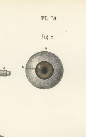 The Eyeball and Its Vessels, Antique Hirschfeld Anatomy Print, 1866, view 4