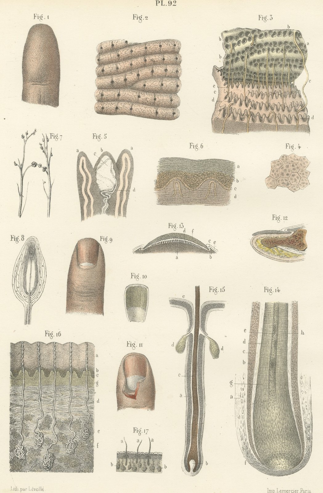 The Skin, Nail and Hair Follicle, Antique Hirschfeld Anatomy Print, 1866