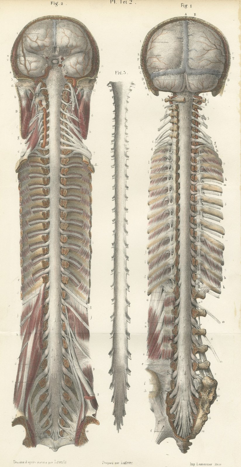 Brain and Spinal Cord in Situ, Hirschfeld Double Folding Plate, 1866