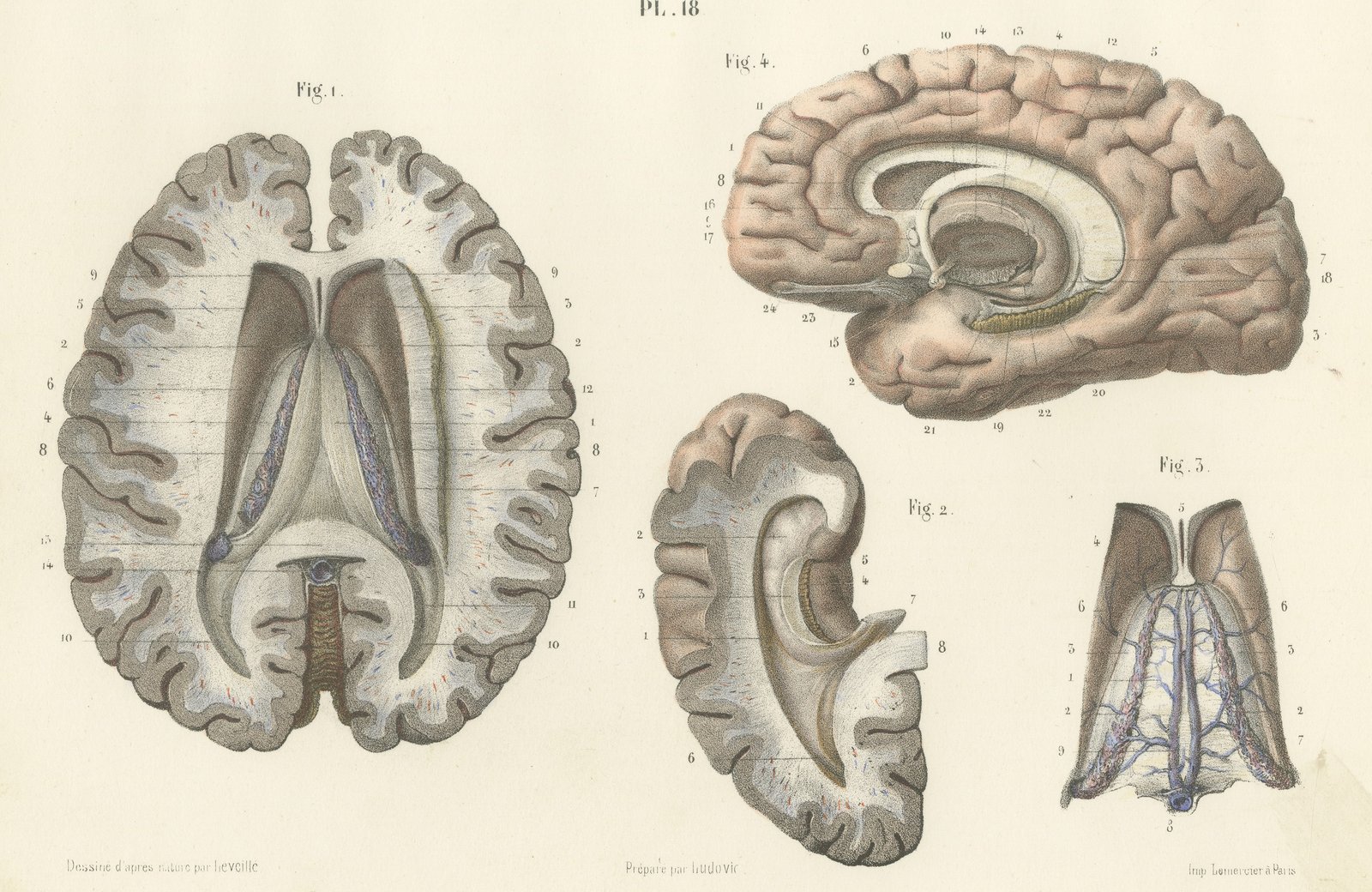 The Fornix and Choroid Plexus, Antique Hirschfeld Anatomy Print, 1866