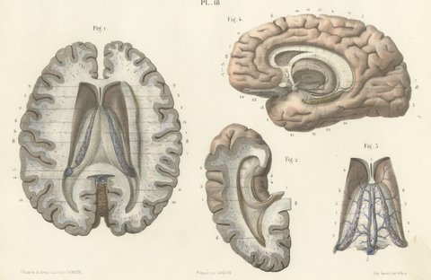 The Fornix and Choroid Plexus, Antique Hirschfeld Anatomy Print, 1866