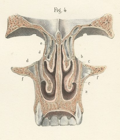 The Lining Membrane of the Nose, Antique Hirschfeld Anatomy Print, 1866, view 6