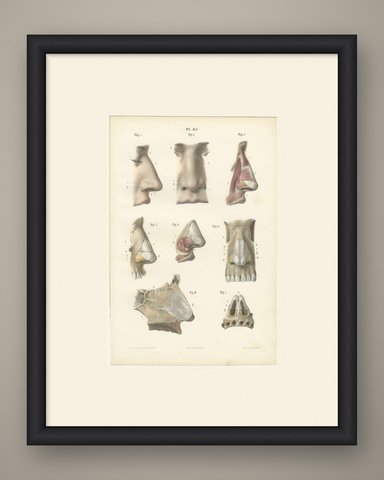 The External Nose and Its Cartilages, Antique Hirschfeld Anatomy Print, 1866, shown framed