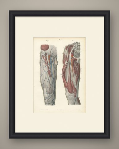 Nerves of the Front of the Thigh, Antique Hirschfeld Anatomy Print, 1866, shown framed