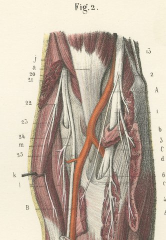 Deep Nerves of the Arm and Forearm, Antique Hirschfeld Anatomy Print, 1866, view 5