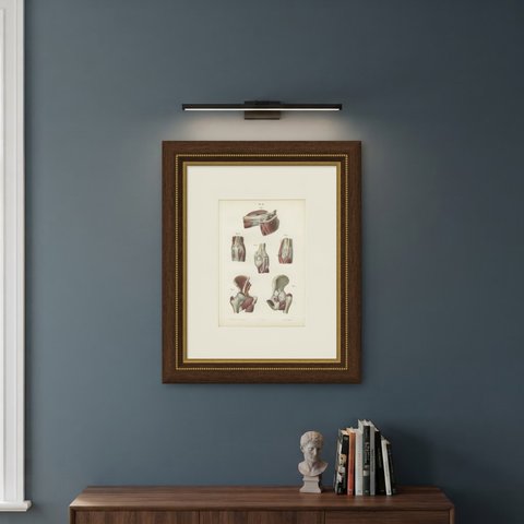 Nerves of the Joints, Antique Hirschfeld Anatomy Print, 1866, shown framed on a wall