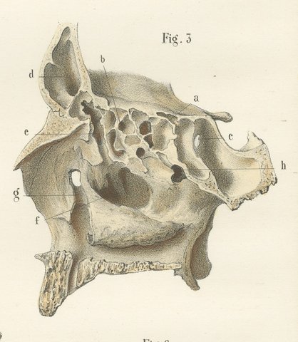 The Bony Nasal Cavity, Antique Hirschfeld Anatomy Print, 1866, view 6