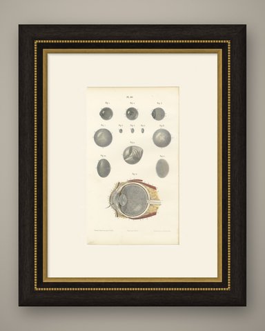 The Crystalline Lens, Antique Hirschfeld Anatomy Print, 1866, shown framed