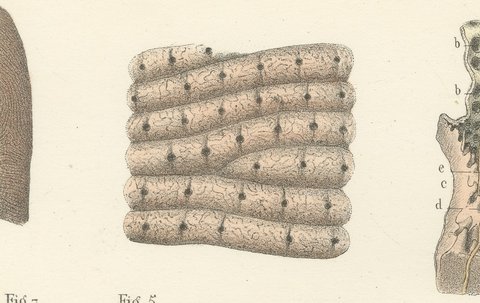 The Skin, Nail and Hair Follicle, Antique Hirschfeld Anatomy Print, 1866, view 5