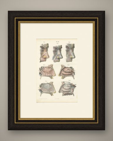 Vessels and Olfactory Nerves of the Nose, Antique Hirschfeld Anatomy Print, 1866, shown framed