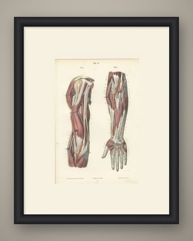 Deep Nerves of the Arm and Forearm, Antique Hirschfeld Anatomy Print, 1866, shown framed
