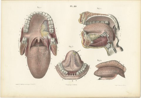 The Mouth, Tongue and Salivary Glands, Antique Hirschfeld Anatomy Print, 1866, view 2