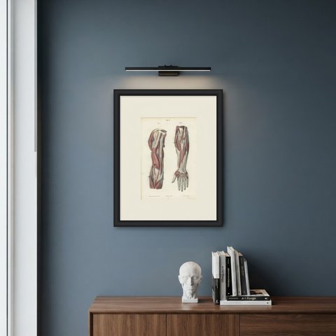 Deep Nerves of the Arm and Forearm, Antique Hirschfeld Anatomy Print, 1866, shown framed on a wall