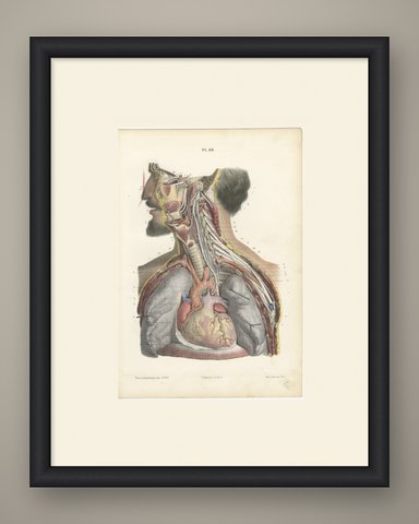 Cranial and Cervical Nerves to the Heart, Antique Hirschfeld Anatomy Print, 1866, shown framed
