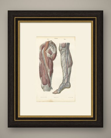 Nerves of the Hip and Lower Limb, Antique Hirschfeld Anatomy Print, 1866, shown framed