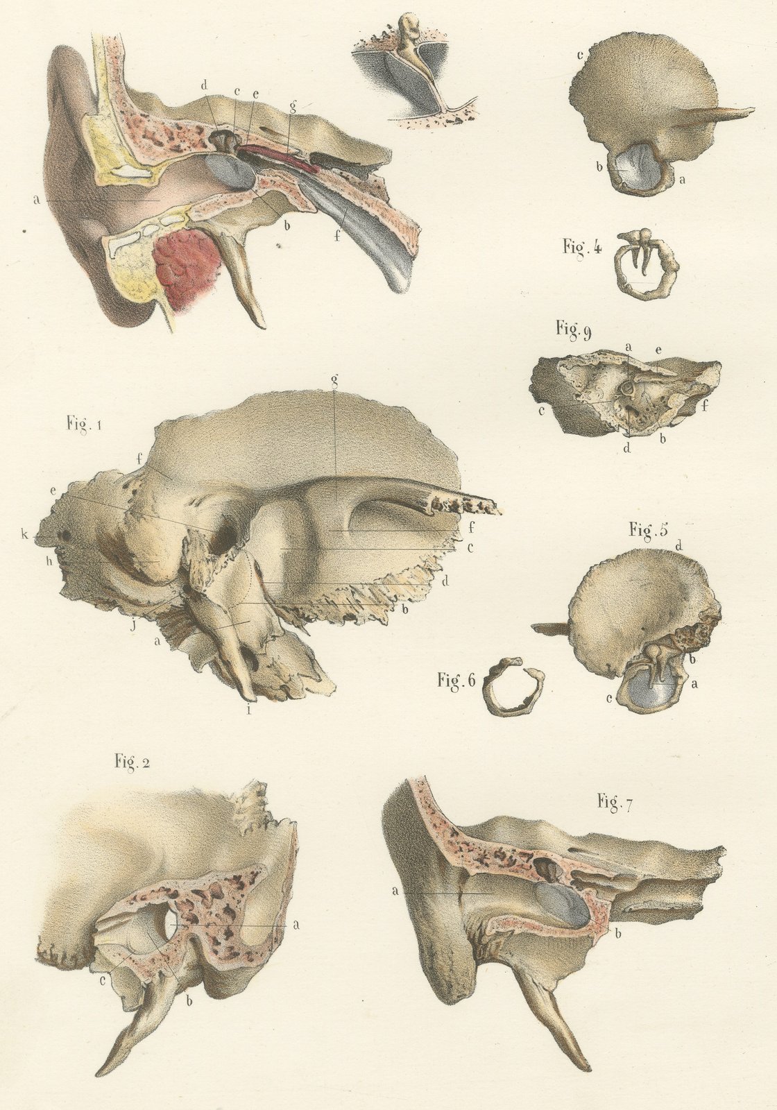 The Temporal Bone and Ear Canal, Antique Hirschfeld Anatomy Print, 1866