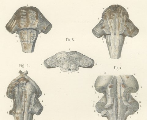 The Brain Stem and Fourth Ventricle, Antique Hirschfeld Anatomy Print, 1866, view 3