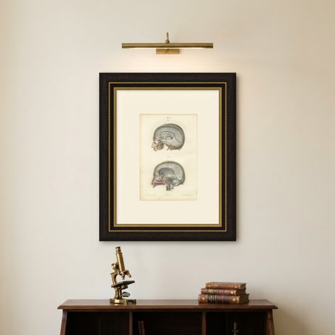 Median Sagittal Sections of the Head, Antique Hirschfeld Anatomy Print, 1866, shown framed on a wall
