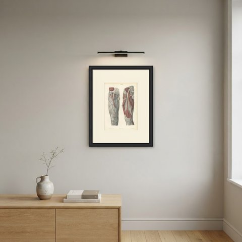 Nerves of the Front of the Thigh, Antique Hirschfeld Anatomy Print, 1866, shown framed on a wall