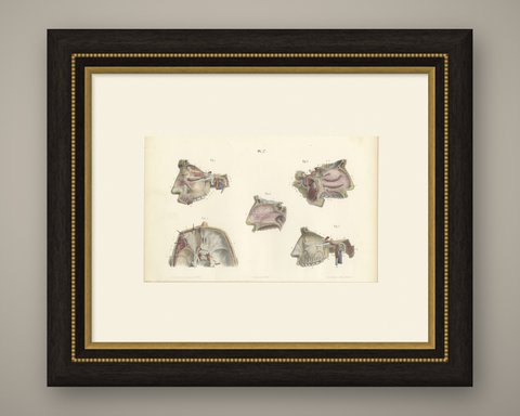 Nerves of the Nose, Palate and Upper Jaw, Antique Hirschfeld Anatomy Print, 1866, shown framed
