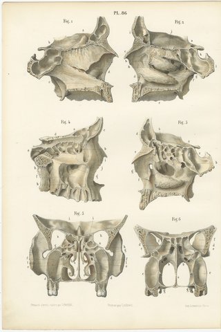 The Bony Nasal Cavity, Antique Hirschfeld Anatomy Print, 1866, view 2