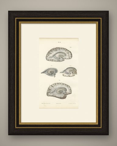 White Matter of the Cerebral Hemisphere, Antique Hirschfeld Anatomy Print, 1866, shown framed