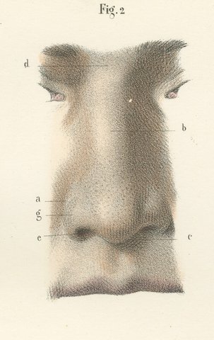 The External Nose and Its Cartilages, Antique Hirschfeld Anatomy Print, 1866, view 6