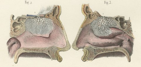 The Olfactory Nerves and Optic Chiasm, Antique Hirschfeld Anatomy Print, 1866, view 5