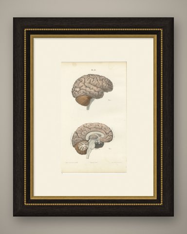 The Brain in Lateral and Median View, Antique Hirschfeld Anatomy Print, 1866, shown framed