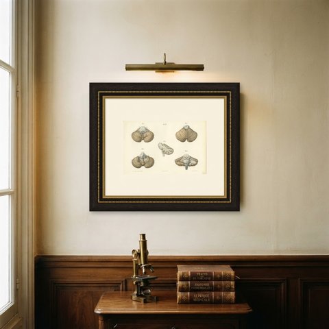 The Cerebellum, Antique Hirschfeld Anatomy Print, 1866, shown framed on a wall