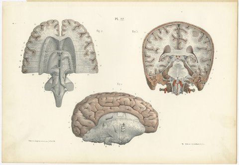 Coronal Section of the Head, Antique Hirschfeld Anatomy Print, 1866, view 2