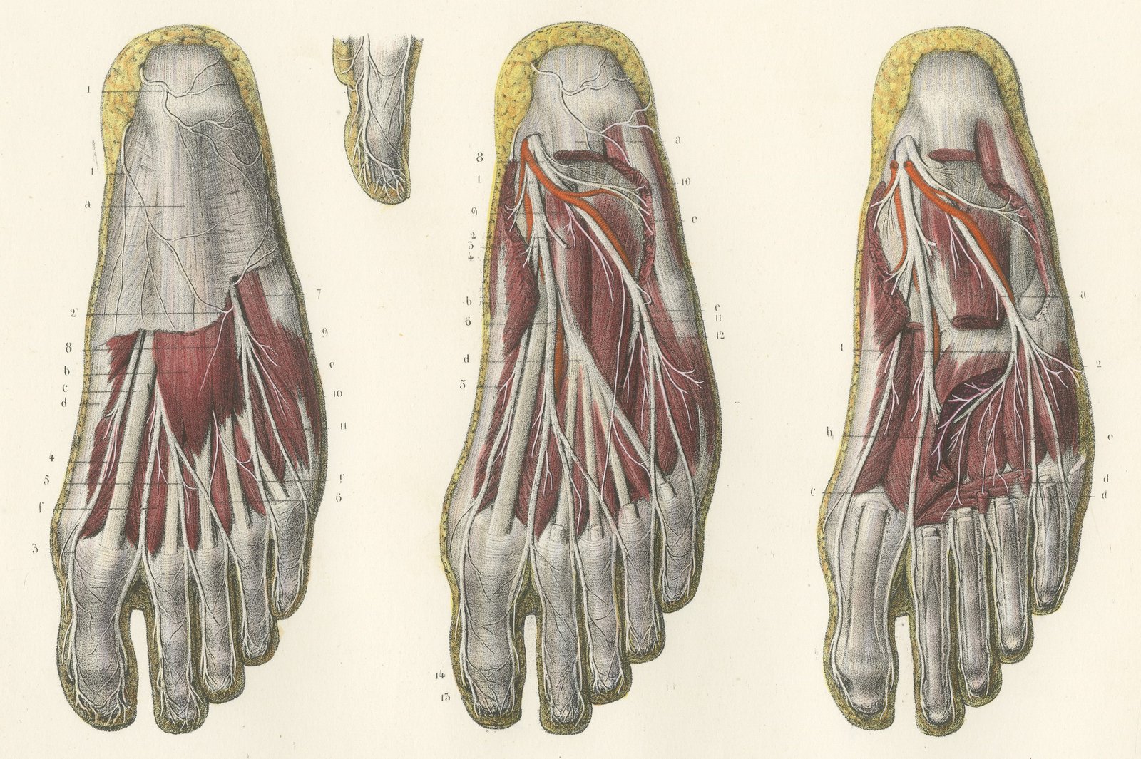 The Sole of the Foot in Four Layers, Antique Hirschfeld Anatomy Print, 1866