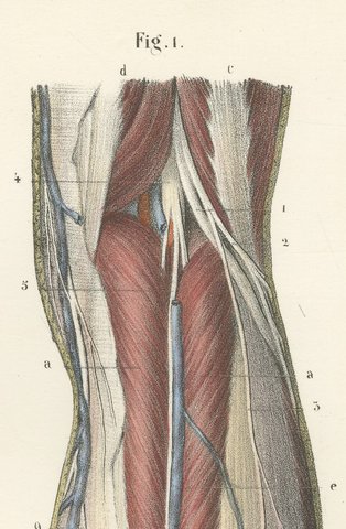 Nerves of the Leg and Foot, Antique Hirschfeld Anatomy Print, 1866, view 5