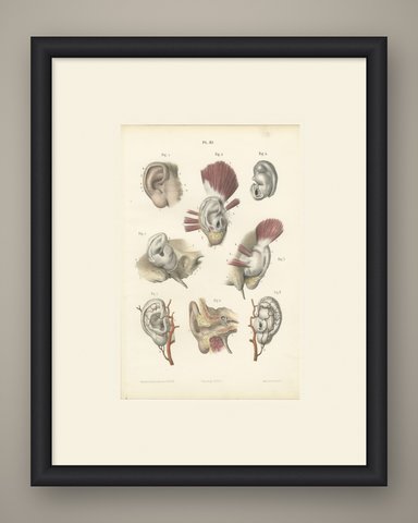 The External Ear, Antique Hirschfeld Anatomy Print, 1866, shown framed
