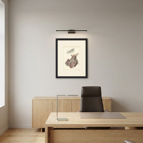 The Brachial Plexus, Antique Hirschfeld Anatomy Print, 1866, shown framed in a room