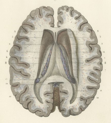 The Fornix and Choroid Plexus, Antique Hirschfeld Anatomy Print, 1866, view 3