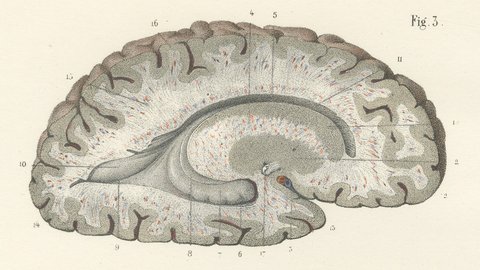 White Matter of the Cerebral Hemisphere, Antique Hirschfeld Anatomy Print, 1866, view 3