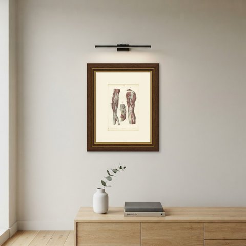 Nerves of the Shoulder and Elbow, Antique Hirschfeld Anatomy Print, 1866, shown framed on a wall