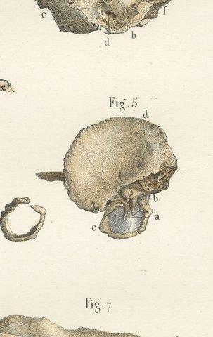 The Temporal Bone and Ear Canal, Antique Hirschfeld Anatomy Print, 1866, view 7