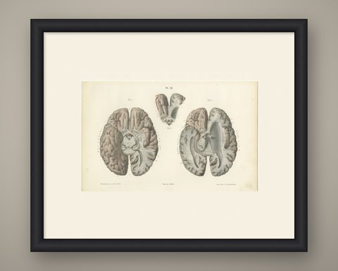The Base of the Brain Dissected, Antique Hirschfeld Anatomy Print, 1866, shown framed
