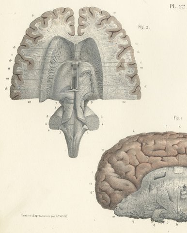 Coronal Section of the Head, Antique Hirschfeld Anatomy Print, 1866, view 3