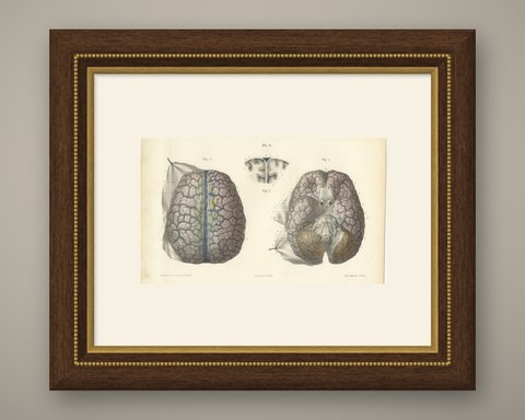 Veins of the Cerebral Hemispheres, Antique Hirschfeld Anatomy Print, 1866, shown framed